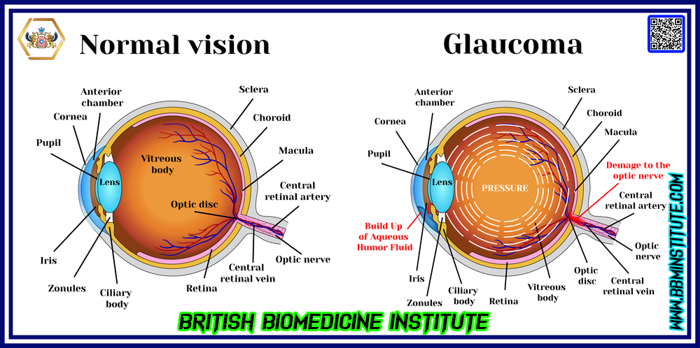 #British #BioMedicine #Institute #An #Evidence And #Skill #Based #eLearning #Platform #bbminstitute #bbmclinicaltrials #britishbiomedicine #bjpmr #bjbmr #BBMI #BSCR #BSMD #BBMCT #BBM #PHM #CPTRA #CCP #MDRA #BSCCP #BBMI #NanoDegree #Pharmaceutical #BioMedical #Clinical #Research #Medical #Device #offers #Skilled #NanoDegree in #Clinical #Trials, #Pharmacovigilance and #Regulatory #Affairs (#CTPRA) #Clinical #Child #Psychology #Medical #Device #Regulatory #Affairs #Public #Health #Management #BritishYogaHealth® #BritishChildPsychology #BritishWorldNews #BritishBioMolecule #BritishBioMedicineClinicalTrials #BritishYogaHealth #EvidenceBasedSkills #ExclusiveAIIMSHospital #Dermatologytrials #CardiovascularTrials #DiabetesTrials #OncologyTrials #HematologyTrials #PediatricTrials #CovidTrials #NeuroScienceTrials #GyneacologyTrials #GastroenterologyTrials #RareDiseaseTrials #AutoImmuneTrials #InfectiousDiseaseTrials #EndocrineTrials #OpthalmologyTrials #NephrologyTrials #ConductClinicalTrials #directorbbmclinicaltrialscom #checkyourplagiarism #NewApprovedDrug #YogaTeacherTrainingProgram #YTTP #BYH #50YTTP #100YTTP #200YTTP #300YTTP #500YTTP #BritishSchoolOfClinicalResearch #BritishSchoolOfClinicalChildPsychology #BritishSchoolOfMedicalDevice #BritishSchoolOfYogaHealth #YogaProfessor